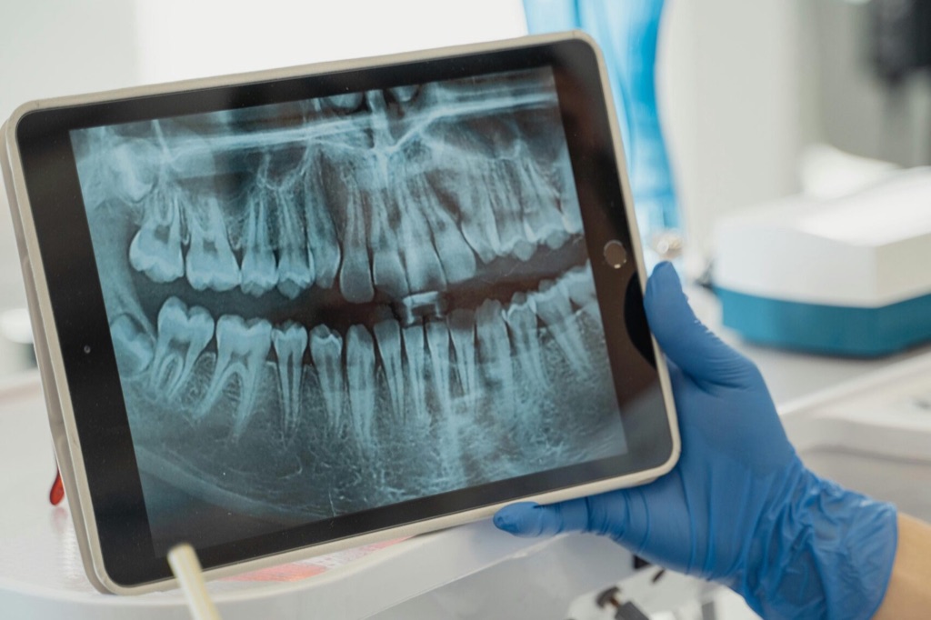 Radiografía panorámica en una tableta para valorar el hueso que sujeta los dientes